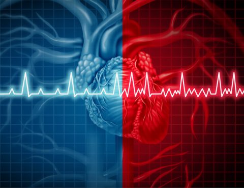 Comparação entre um coração normal e outro com fibrilação atrial