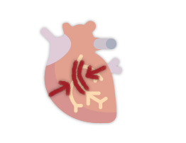 Imagem ilustrativa que representa a angina