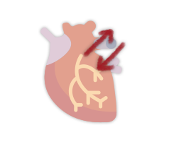 arritimia-cardiaca