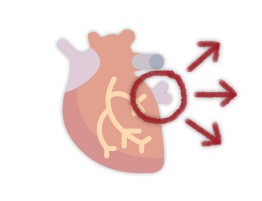 estenose-mitral