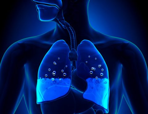 edema agudo dos pulmões