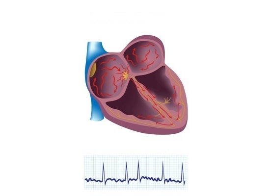 Coração com fibrilação atrial